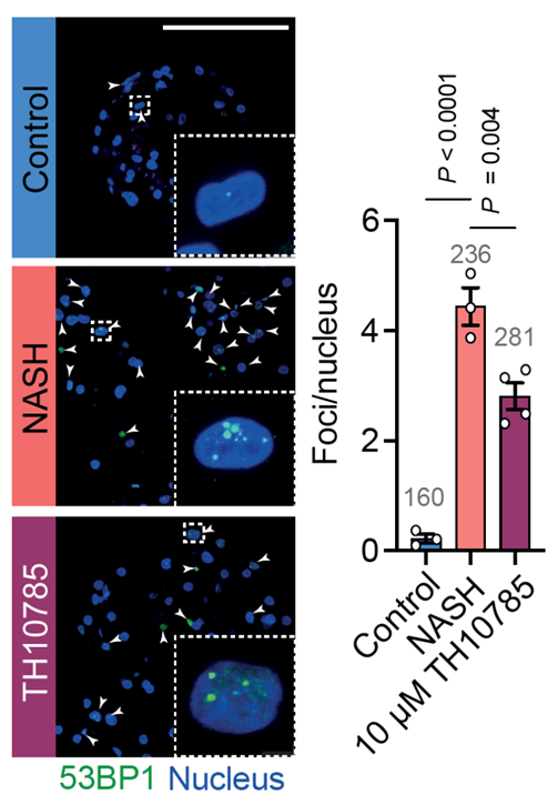 Image and graph of the effect on 53BP1